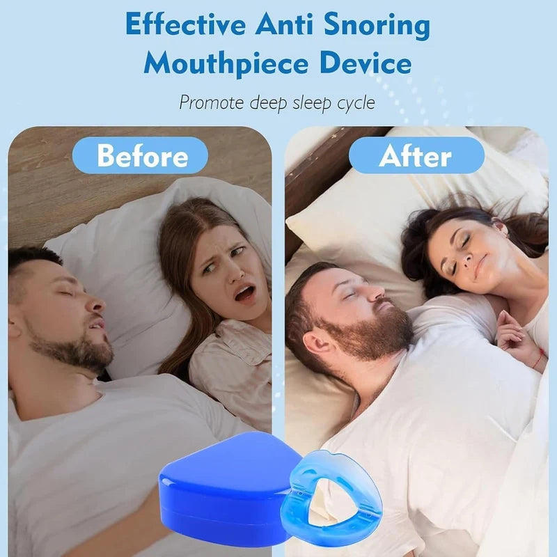 Anti Snore Mouthpiece – Easy-to-Use Snoring Relief Solution